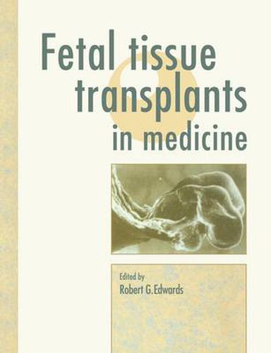 Cover image for Fetal Tissue Transplants in Medicine