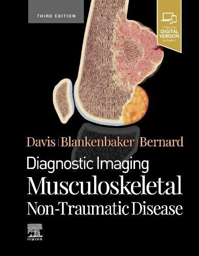 Cover image for Diagnostic Imaging: Musculoskeletal Non-Traumatic Disease