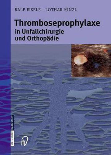 Cover image for Thromboseprophylaxe in Unfallchirurgie und Orthopadie