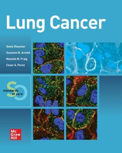 Cover image for Lung Cancer:  Standards of Care