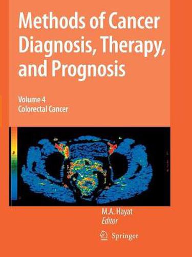 Cover image for Methods of Cancer Diagnosis, Therapy and Prognosis: Colorectal Cancer