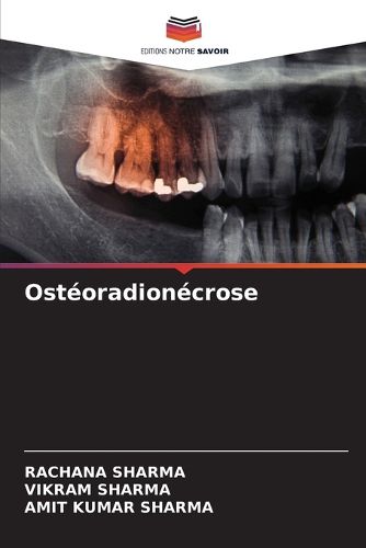 Cover image for Osteoradionecrose