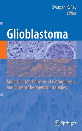 Cover image for Glioblastoma:: Molecular Mechanisms of Pathogenesis and Current Therapeutic Strategies
