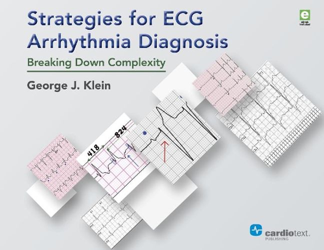 Cover image for Strategies for ECG Arrhythmia Diagnosis: Breaking Down Complexity