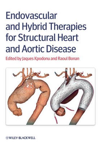 Cover image for Endovascular and Hybrid Therapies for Structural Heart and Aortic Disease