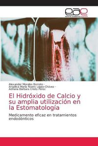 Cover image for El Hidroxido de Calcio y su amplia utilizacion en la Estomatologia