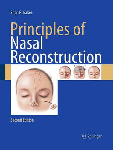 Cover image for Principles of Nasal Reconstruction