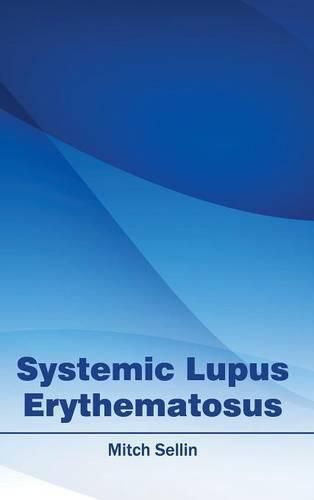 Cover image for Systemic Lupus Erythematosus