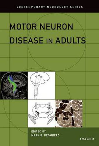 Cover image for Motor Neuron Disease in Adults