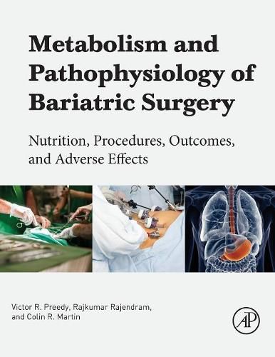 Metabolism and Pathophysiology of Bariatric Surgery: Nutrition, Procedures, Outcomes and Adverse Effects