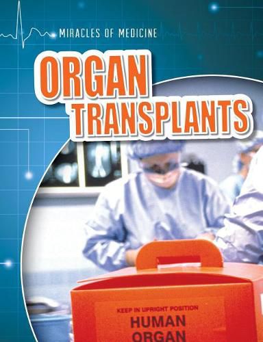 Cover image for Organ Transplants