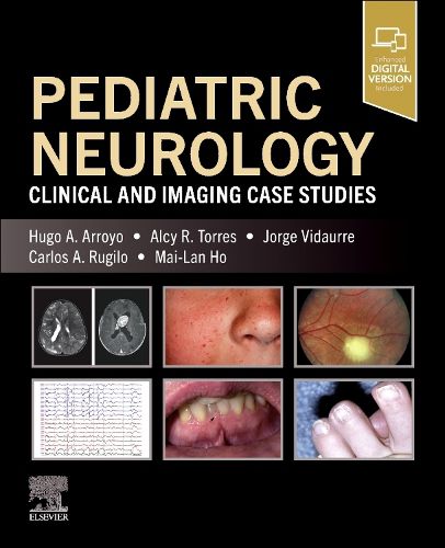 Pediatric Neurology