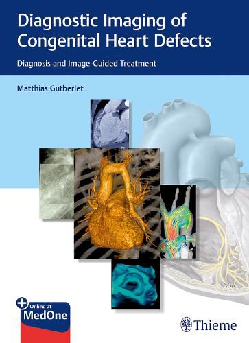 Cover image for Diagnostic Imaging of Congenital Heart Defects: Diagnosis and Image-Guided Treatment