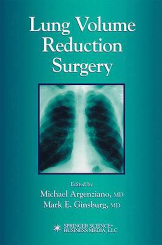 Cover image for Lung Volume Reduction Surgery