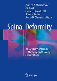 Cover image for Spinal Deformity: A Case-Based Approach to Managing and Avoiding Complications