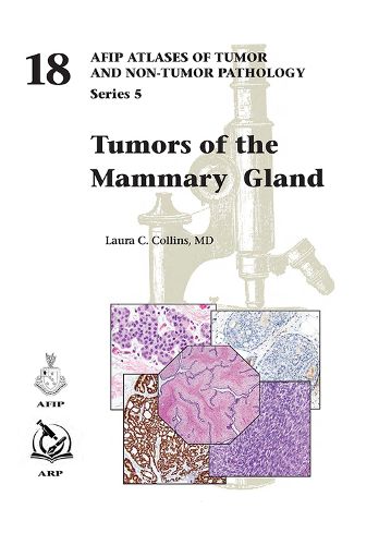 Cover image for Tumors of the Mammary Gland
