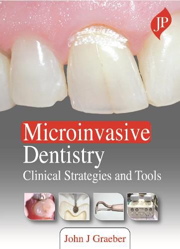 Cover image for Microinvasive Dentistry: Clinical Strategies and Tools