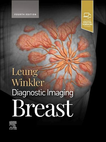 Cover image for Diagnostic Imaging: Breast