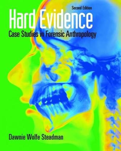 Cover image for Hard Evidence: Case Studies in Forensic Anthropology