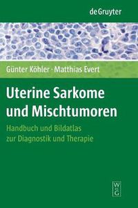 Cover image for Uterine Sarkome und Mischtumoren: Handbuch und Bildatlas zur Diagnostik und Therapie