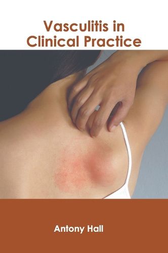 Cover image for Vasculitis in Clinical Practice