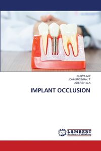 Cover image for Implant Occlusion