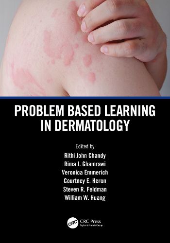 Problem Based Learning in Dermatology