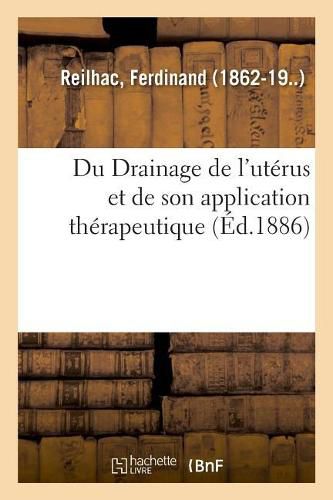 Du Drainage de l'Uterus Et de Son Application Therapeutique