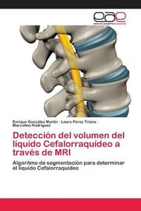 Cover image for Deteccion del volumen del liquido Cefalorraquideo a traves de MRI