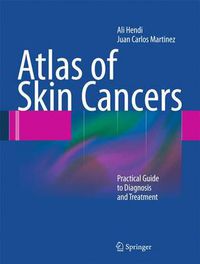 Cover image for Atlas of Skin Cancers: Practical Guide to Diagnosis and Treatment