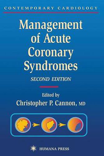 Management of Acute Coronary Syndromes