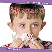 Cover image for Nosebleeds