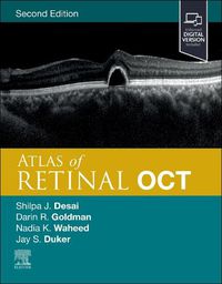 Cover image for Atlas of Retinal OCT