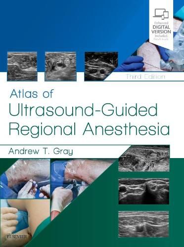 Cover image for Atlas of Ultrasound-Guided Regional Anesthesia