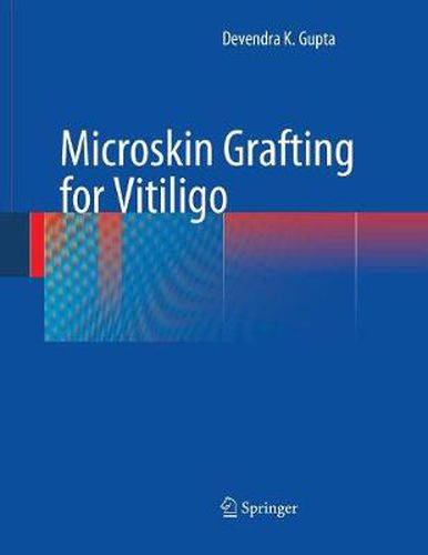 Cover image for Microskin Grafting for Vitiligo