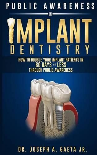 Cover image for Public Awareness In Implant Dentistry: How To Double Your Implant Patients In 60 Days Or Less Through Public Awareness