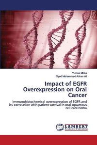 Cover image for Impact of EGFR Overexpression on Oral Cancer