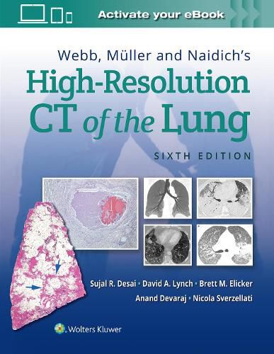 Webb, Muller and Naidich's High-Resolution CT of the Lung