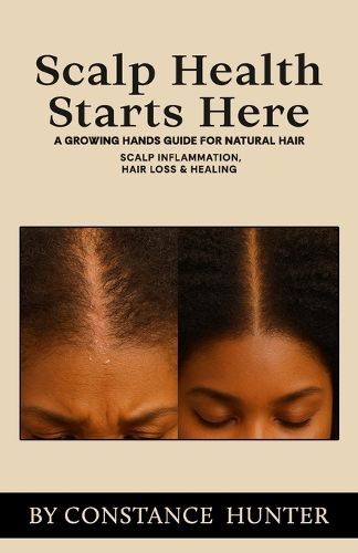 Cover image for Scalp Health Starts Here