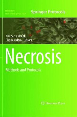 Necrosis: Methods and Protocols