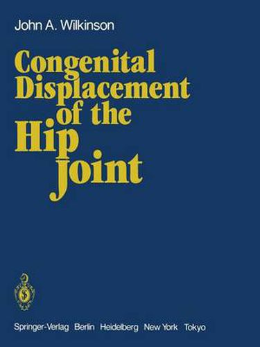 Cover image for Congenital Displacement of the Hip Joint