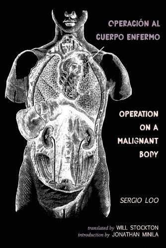 Cover image for Operacion al Cuerpo Enfermo / Operation on a Malignant Body