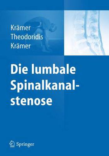 Cover image for Die lumbale Spinalkanalstenose