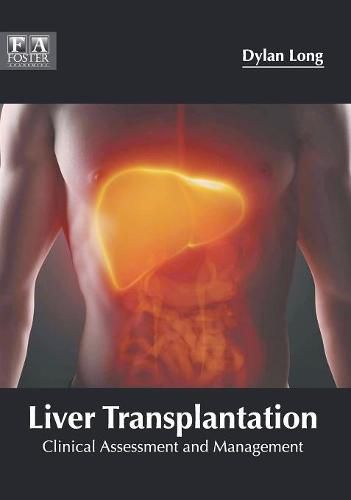 Cover image for Liver Transplantation: Clinical Assessment and Management