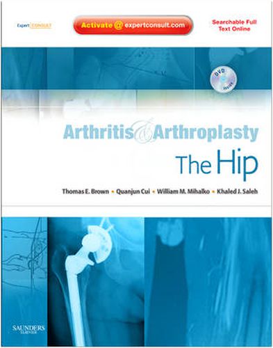 Arthritis and Arthroplasty: The Hip: Expert Consult - Online, Print and DVD