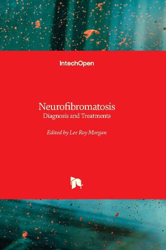 Cover image for Neurofibromatosis