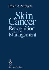 Cover image for Skin Cancer: Recognition and Management