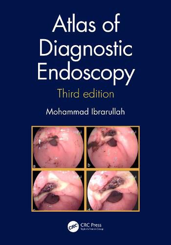 Cover image for Atlas of Diagnostic Endoscopy