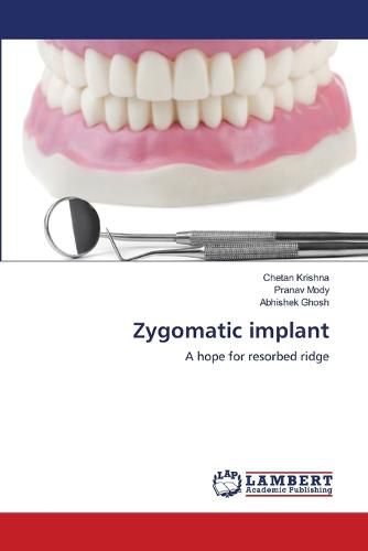 Cover image for Zygomatic implant