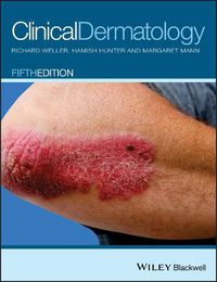 Cover image for Clinical Dermatology 5e